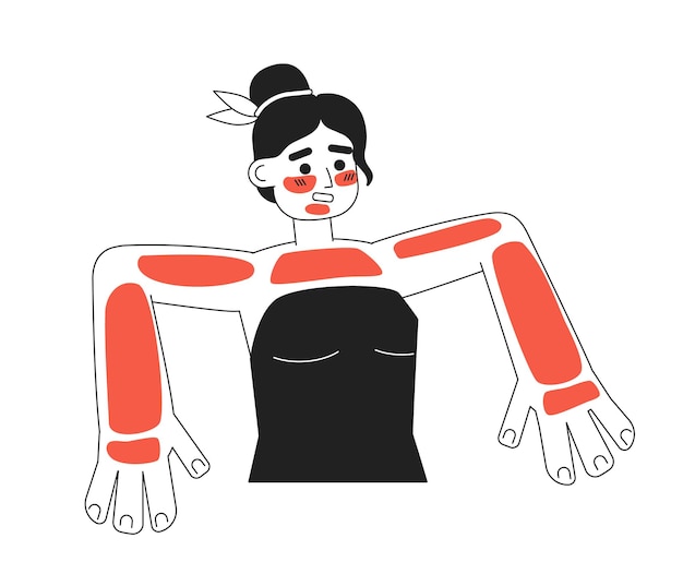 Mujer joven con quemaduras de sol severas carácter vectorial plano monocromático