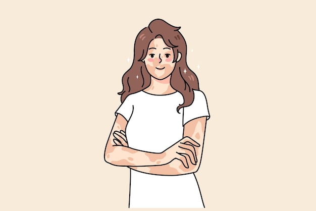 Mujer joven sonriente con enfermedad de la piel siente cuerpo positivo. niña feliz en el día internacional del vitíligo. día de despigmentación. concepto de problema de cuidado de la piel. ilustración de vector plano.