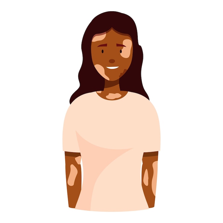 Vector mujer joven con vitiligo sonriendo y sintiéndose segura
