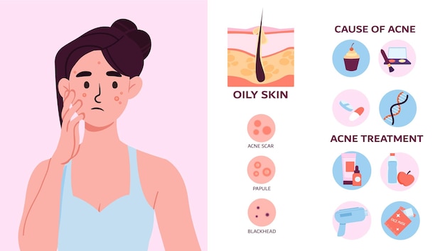 Mujer con problema con el concepto de piel Cuidado de la piel y lucha contra el acné Tratamientos de belleza y productos cosméticos Piel grasa con pápula y espinilla Dibujo vectorial plano de dibujos animados