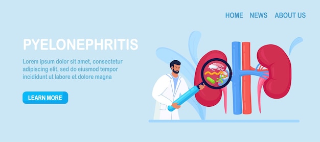 Nefrólogo de pequeños médicos que diagnostica la enfermedad de pielonefritis. Diagnóstico hospitalario, tratamiento de riñón. Médico con lupa. Urología y Nefrología, Nefroptosis, Insuficiencia Renal, Cistitis