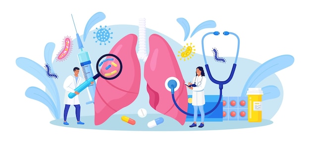 Neumología. Pequeños médicos que examinan los pulmones. Tuberculosis, neumonía, tratamiento o diagnóstico de cáncer de pulmón. Inspección de órganos internos para detectar enfermedades, enfermedades o problemas del sistema respiratorio
