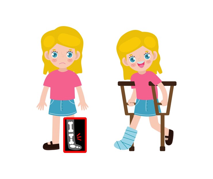 Vector niños caucásicos de dibujos animados lindo con pierna rota en rayos x y recuperándose con yeso y muletas tratamiento de fractura ósea