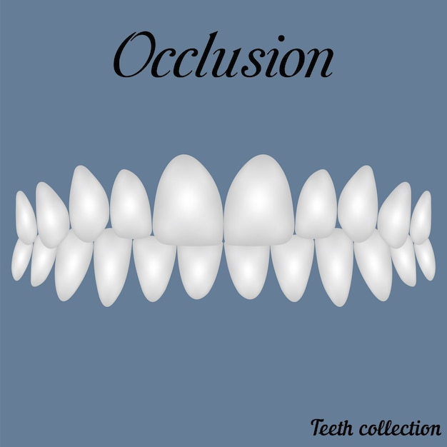 Vector oclusión dientes apretados