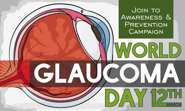 Vector ojo enfermo con fecha de recordatorio para el día mundial del glaucoma con algunos preceptos para prevenir esta enfermedad