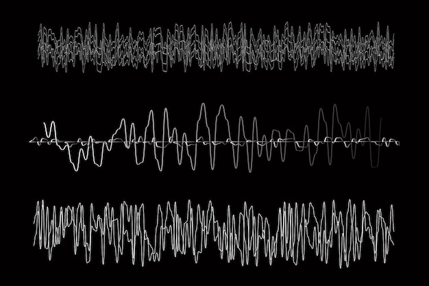 Ondas sonoras vectoriales