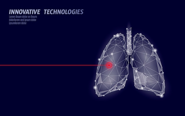 Operación de cirugía láser de pulmones humanos bajo poli. medicina enfermedad tratamiento farmacológico zona dolorosa. los triángulos rojos poligonales 3d render forma. farmacia, tuberculosis, cáncer, plantilla, ilustración