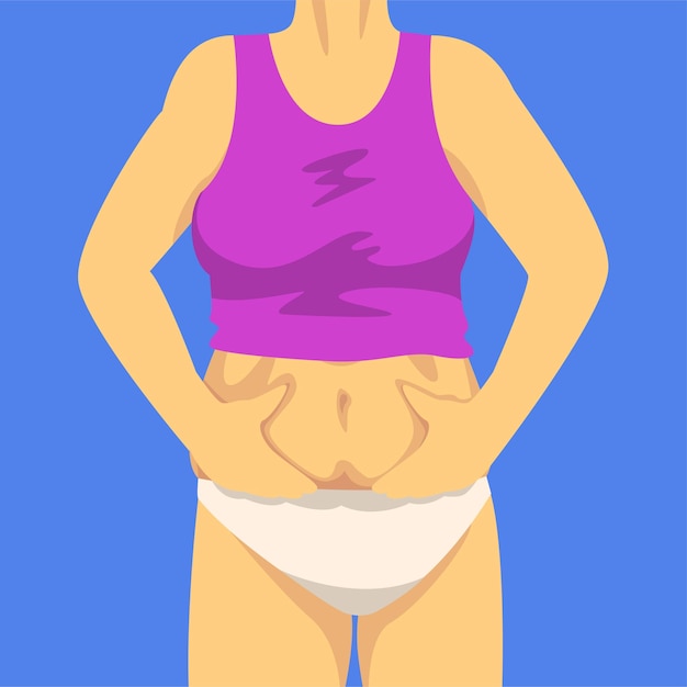 Vector parte del cuerpo femenino mujer apretando el pliegue del vientre con las manos vista frontal figura humana después de la pérdida de peso obesidad y problemas de alimentación no saludable ilustración vectorial estilo plano