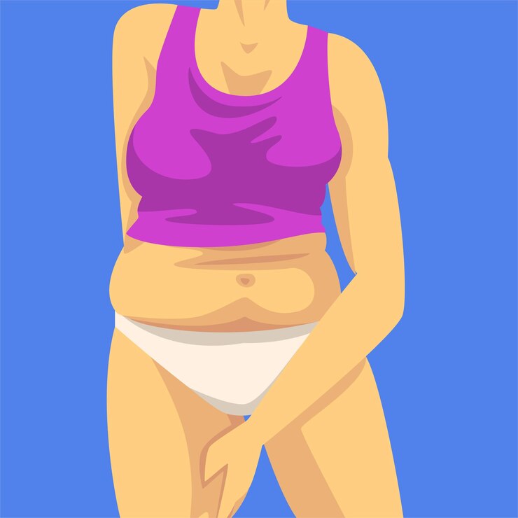 Vector parte del cuerpo femenino con vientre gordo mujer agarrando el pliegue de la cadera con la mano figura humana después de la pérdida de peso obesidad y problemas de alimentación no saludable ilustración vectorial estilo plano