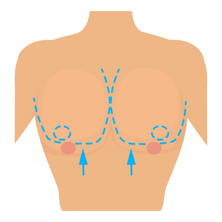 Vector pecho de mujer marcado para icono de cirugía estética ilustración de dibujos animados de pecho de mujer marcado para icono de vector de cirugía estética para web