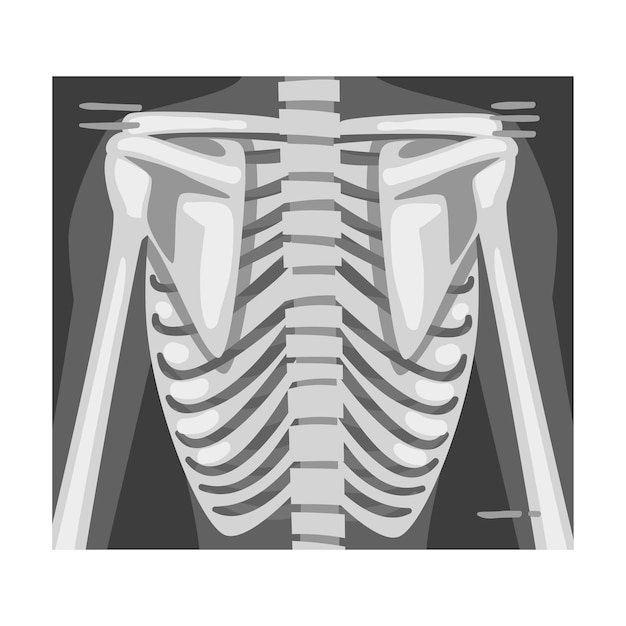 Película de rayos X de la columna vertebral Imagen ilustrada por vector con fines educativos