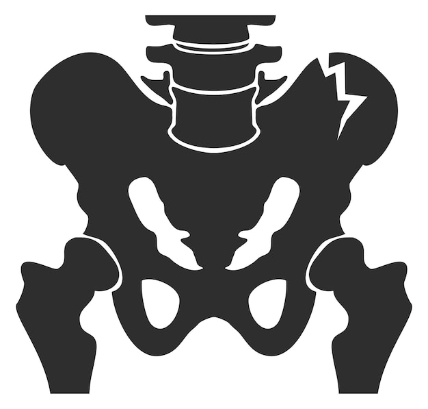 Vector pelvis humana grieta icono negro ilustración de lesión