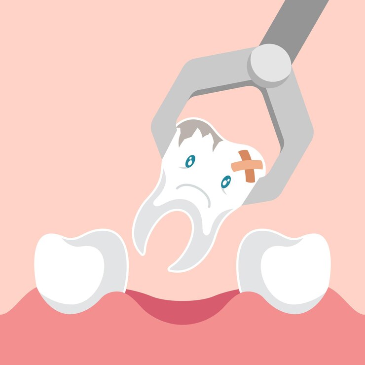 Vector pinza de extracción dental y diente.