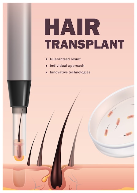 plantilla de estandarte vertical de trasplante de cabello realista