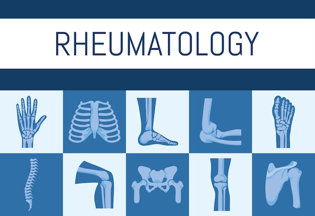 Póster de huesos de reumatología