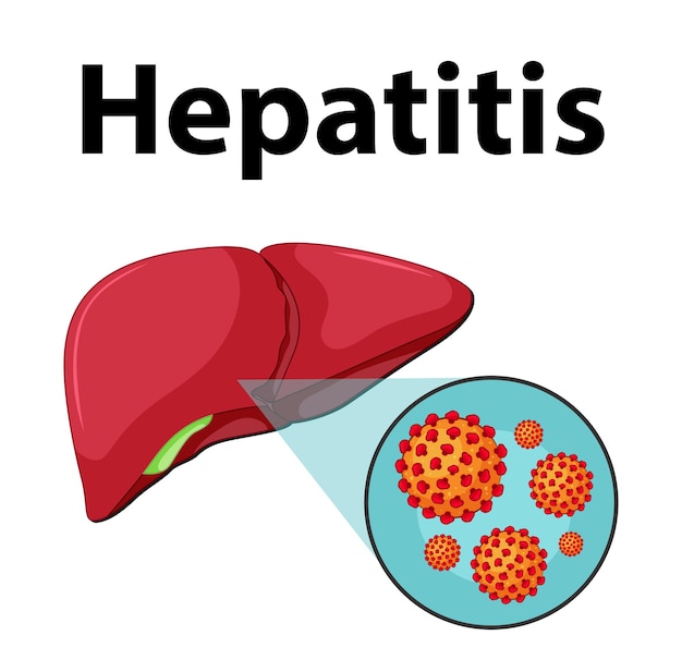 Vector primer plano de la célula del virus de la hepatitis en la anatomía del hígado humano