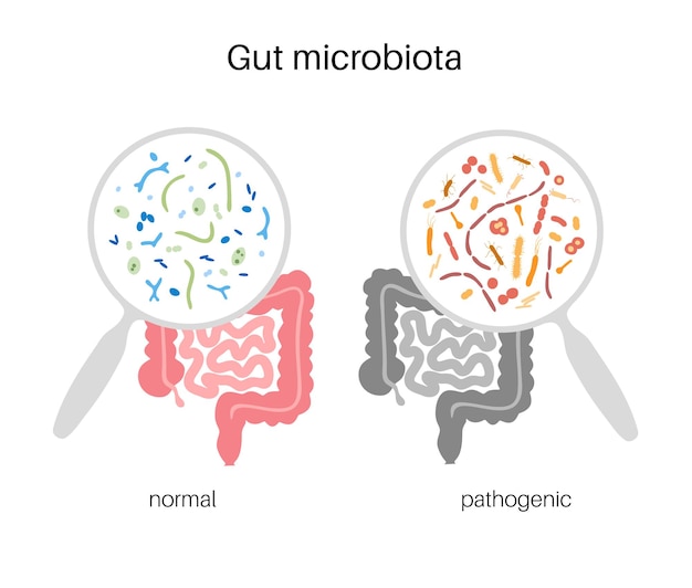 Probióticos. bacterias patógenas y beneficiosas más comunes. ilustración de vector de microbiota intestinal humana