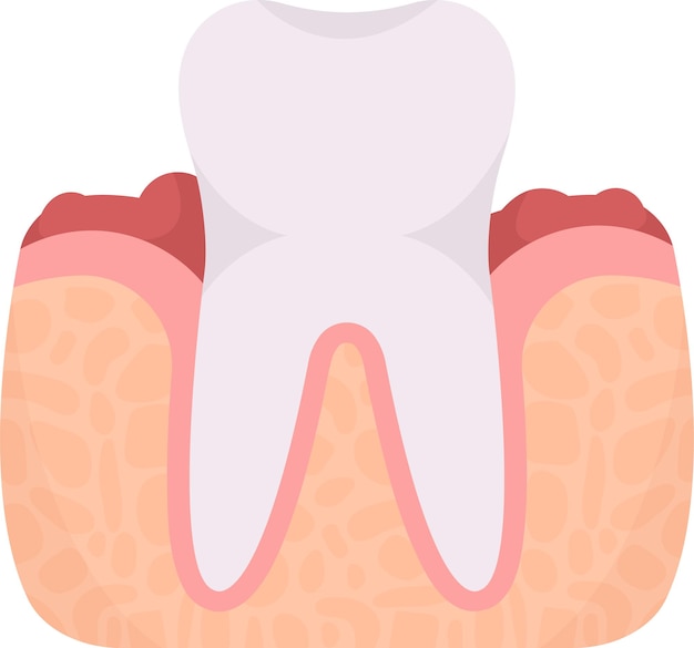 Vector problema dental con gingivitis