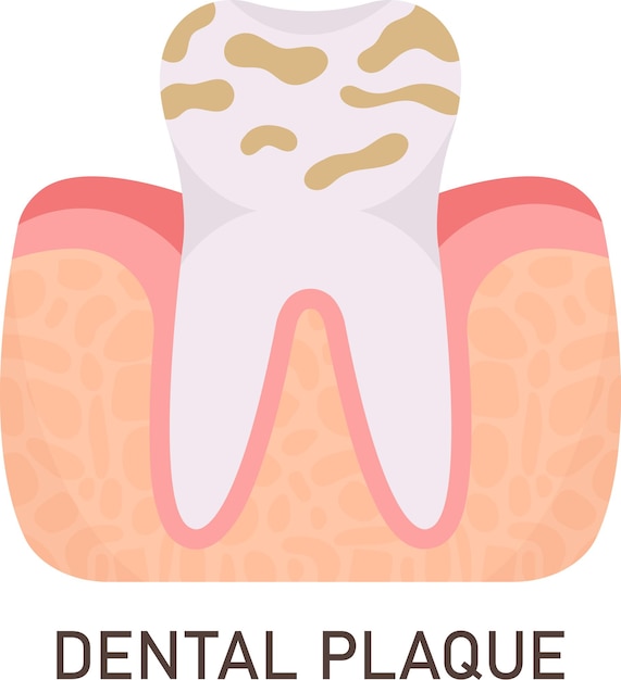 Problema dental con placa dental