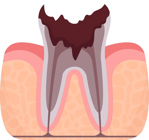 Vector problema de dientes muertos