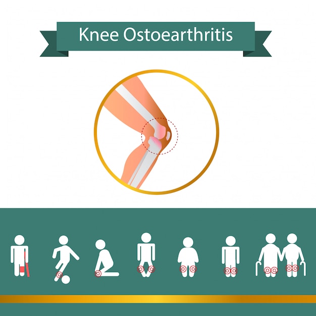 Vector problema de rodilla