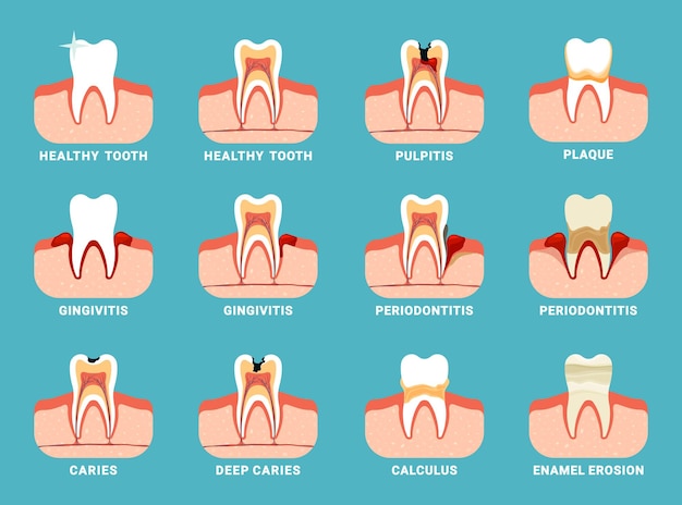 Vector problemas dentales diferentes dientes dañados mal aliento oral información de cuidado dental plantillas planas vectoriales