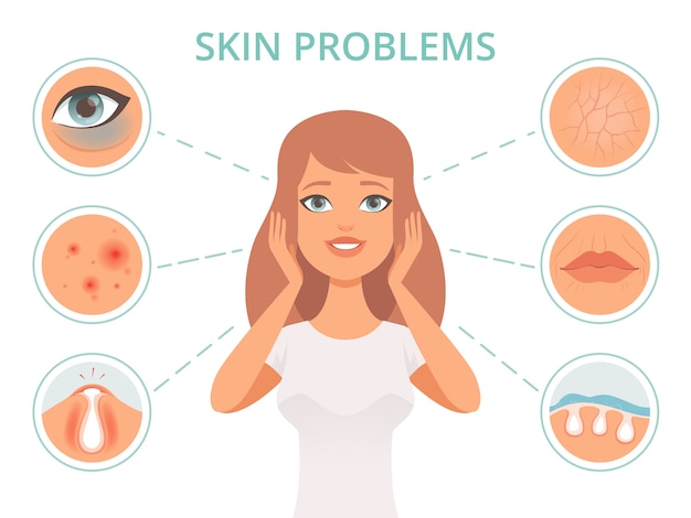 Vector problemas de la piel. belleza mujer exfoliante cuidado cara infección oscuridad matorrales cara aceitosa limpiar símbolos. problema de dermatología de la piel de ilustración, belleza y cuidado facial