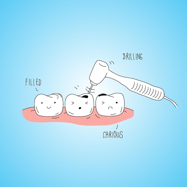 El procedimiento de rellenado dental