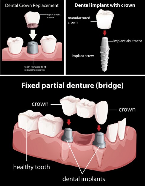 Procedimientos dentales en negro