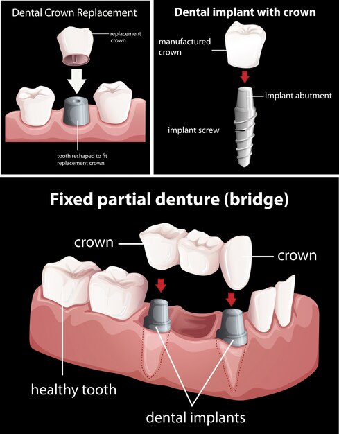 Vector procedimientos dentales en negro