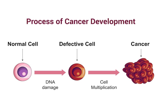 Proceso de desarrollo de células cancerosas Ilustración vectorial del diagrama científico