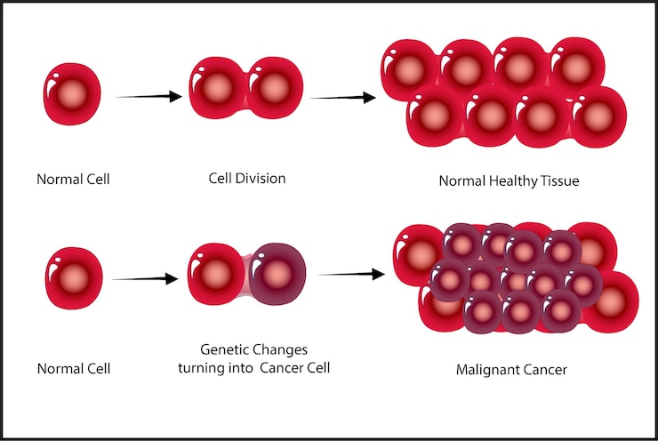 Vector proceso de desarrollo de células cancerosas.
