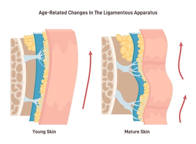 Vector proceso de envejecimiento y aflojamiento de los ligamentos de la piel facial piel de primer plano