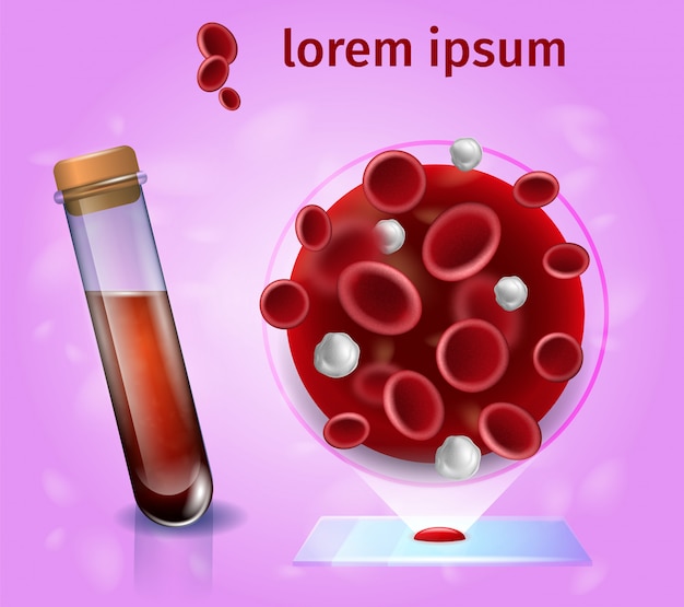 Prueba de sangre realista vector concepto