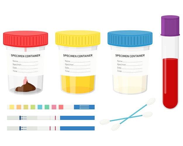 Pruebas de laboratorio. Analice la orina, las heces, el semen y la sangre en frascos de plástico con tapas de colores.