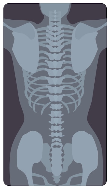 Radiografía anterior de la caja torácica y la pelvis humanas. Imagen de rayos X o imagen radiográfica de huesos y articulaciones, vista frontal. Diagnóstico médico. Ilustración de vector monocromo en estilo de dibujos animados plana