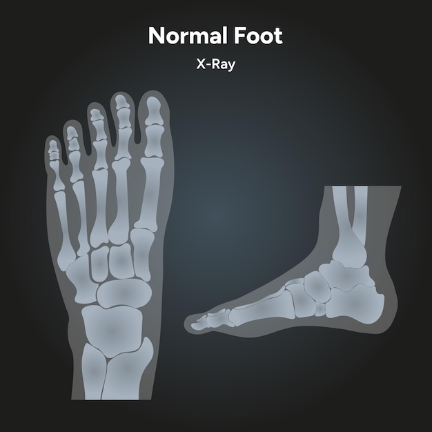 Vector radiografía normal del pie
