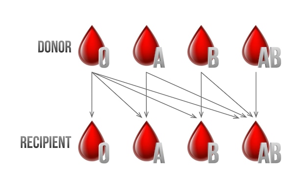 Receptor y donante tipos de sangre ab ab o compatibilidad específica entre grupos para la donación de sangre