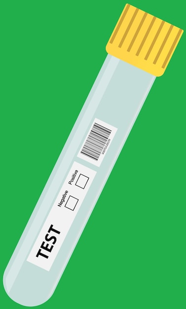 Vector resultado de la prueba de la muestra de sangre del ensayo médico tubo de ensayo en blanco