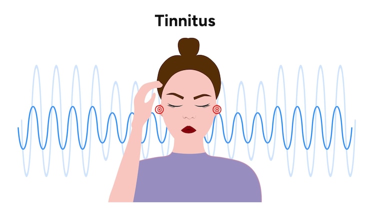 Vector ruido de tinnitus en la enfermedad de zumbido y mareos en el oído humano