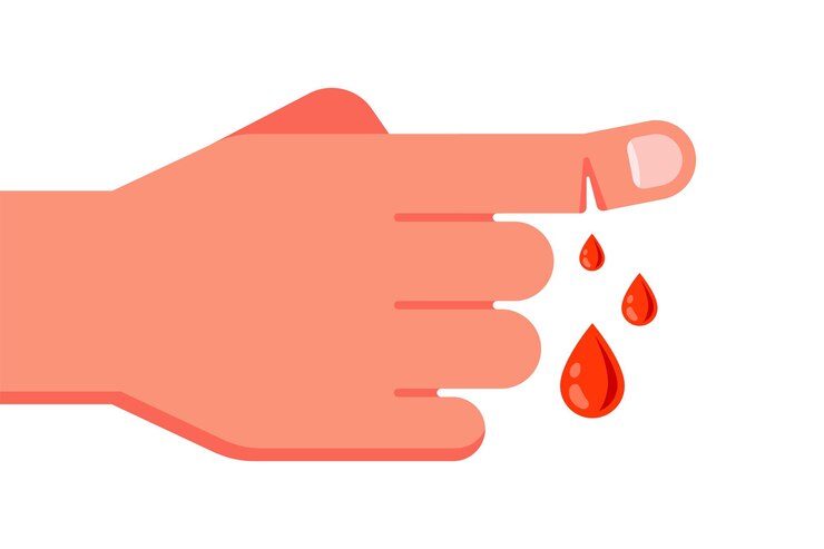 Vector la sangre roja fluye del dedo índice cortado. departamento