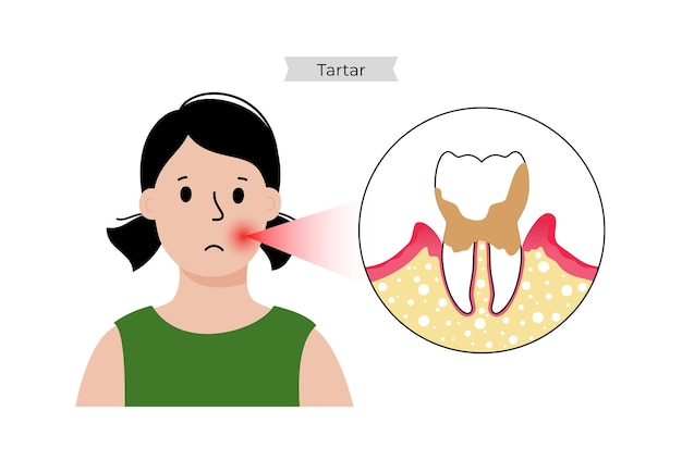 Vector sarro, placa, dolor de muelas. niño en clínica dental. dentista, estomatología, ilustración de vector plano de cartel de anatomía dental. bandera médica de higiene bucal. medicina, pastillas, diagnóstico y tratamiento.