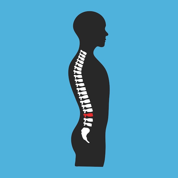 Vector silueta humana y columna vertebral problema de dolor de espalda concepto de atención médica