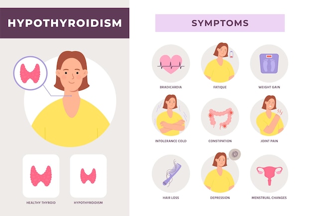 Vector síntomas de la enfermedad del hipotiroidismo infografía con carácter de mujer glándula tiroides poco activa afiche vectorial del problema de salud del sistema endocrino ilustración de hipertiroidismo y endocrinología