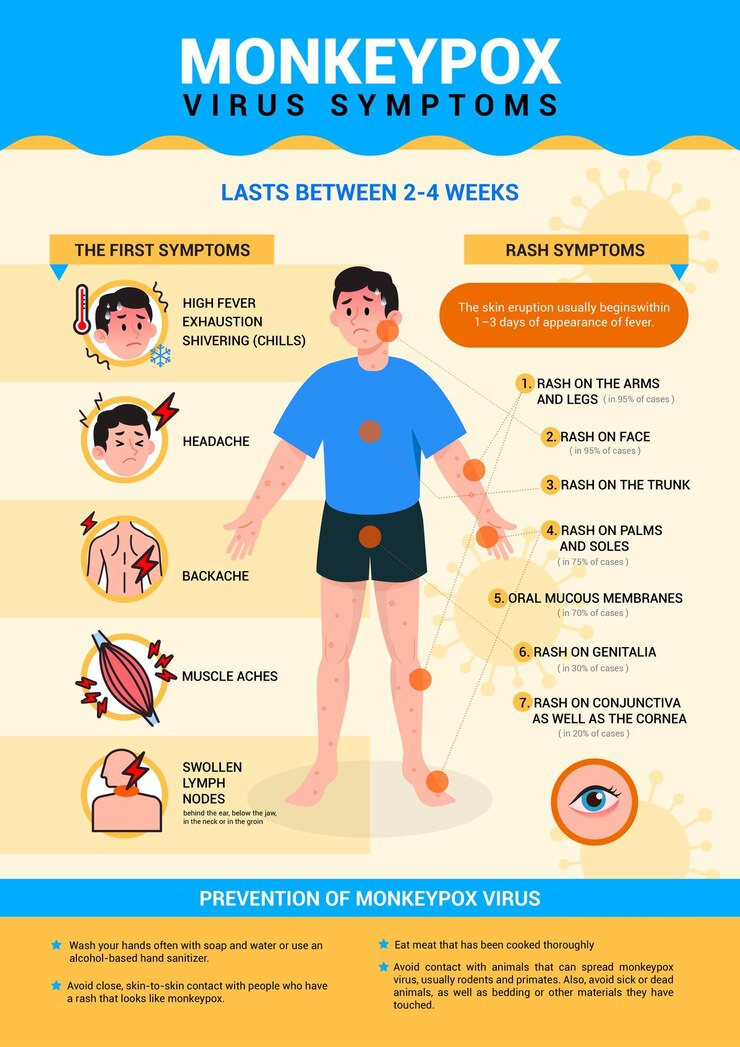 Vector síntomas del virus de la viruela del mono y diseño de vectores de carteles infográficos de prevención