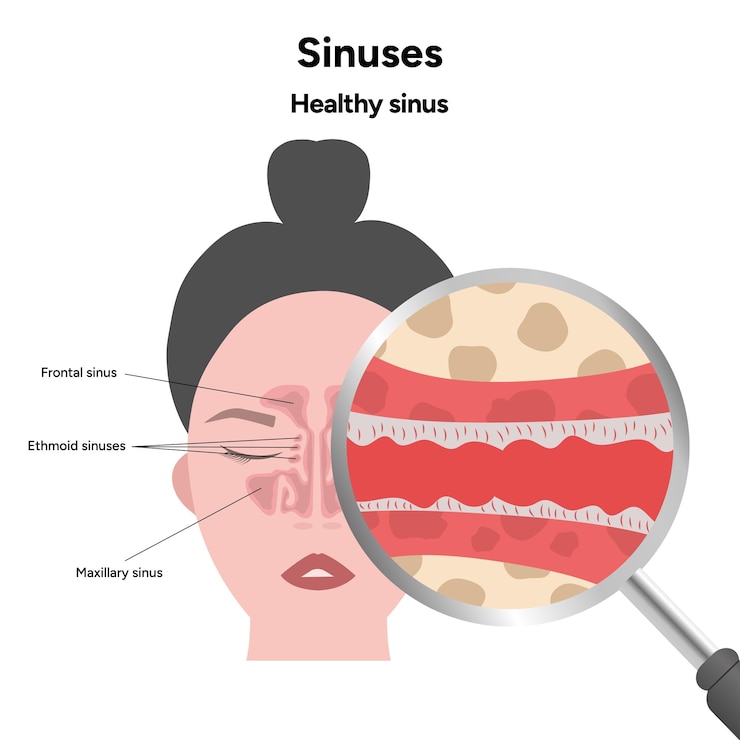Vector sinus anatomía seno sano y sinusitis nariz anatomía nasal inflamación cavidad nasal