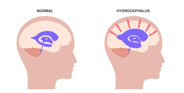 Sistema ventricular