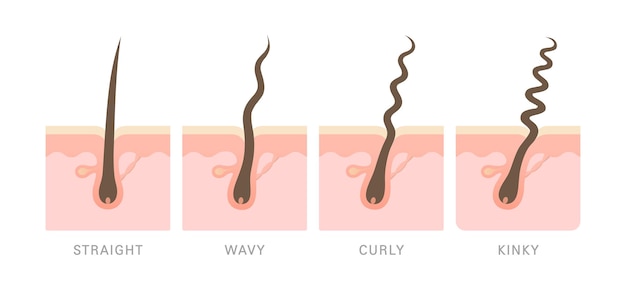Tipos de cabello con folículos sección transversal de cabello recto ondulado rizado pervertido en la capa del cuero cabelludo