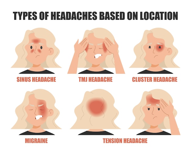 Tipos de dolor de cabeza según la ubicación