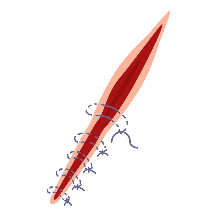 Vector trabajo de aguja de sutura icono vector de dibujos animados lesión de la piel atención médica